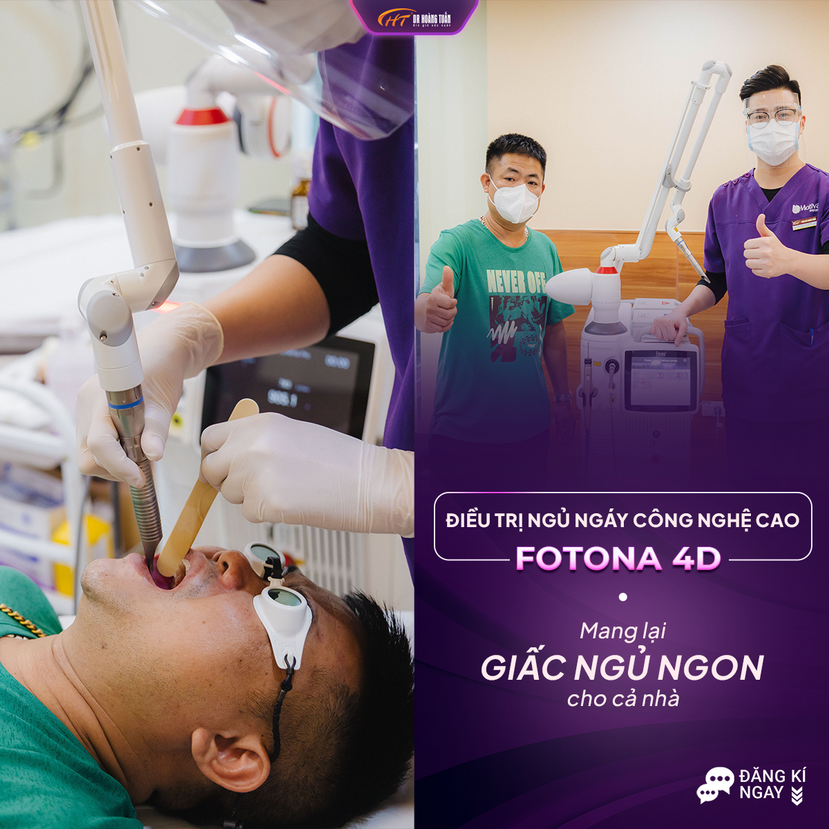 điều trị ngủ ngáy